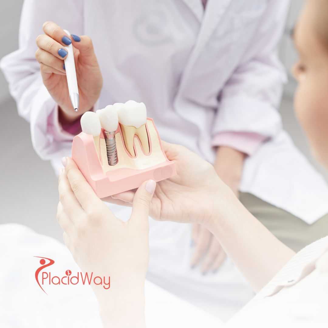 Dental Implants from Toronto to Los Algodones, Mexico – Save Big on Quality Dental Care