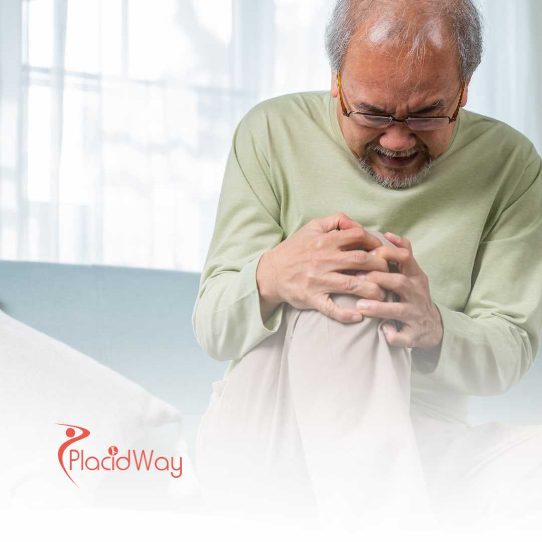 Stem Cell Therapy for Osteoarthritis in Germany: Advanced Treatment for UK Patients from London