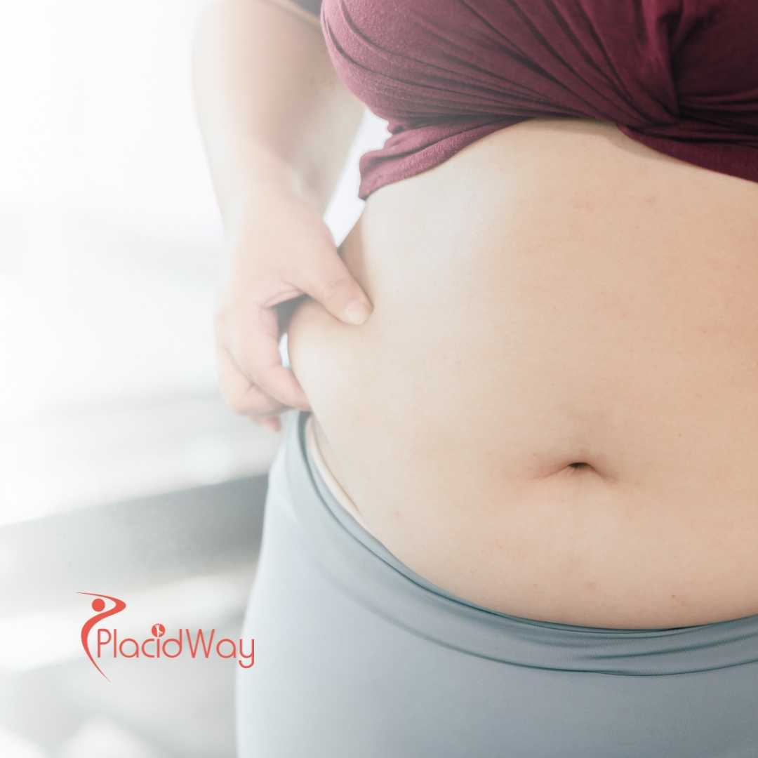 Bypass gástrico para pacientes de Vancouver en Mexicali, México