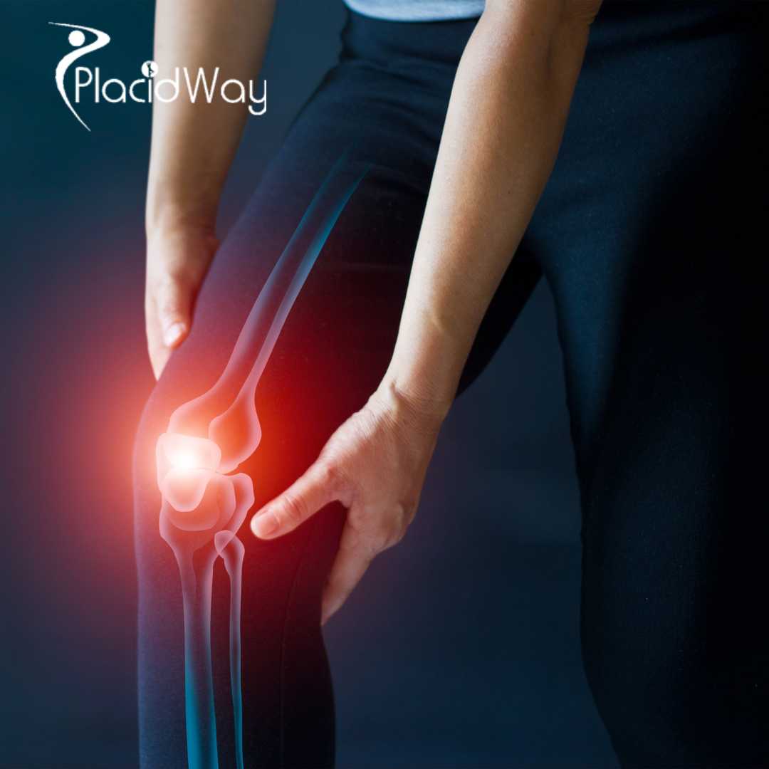 Stem Cell Therapy in Japan for Knee Arthritis Patients Considering Advanced Non-Surgical Options