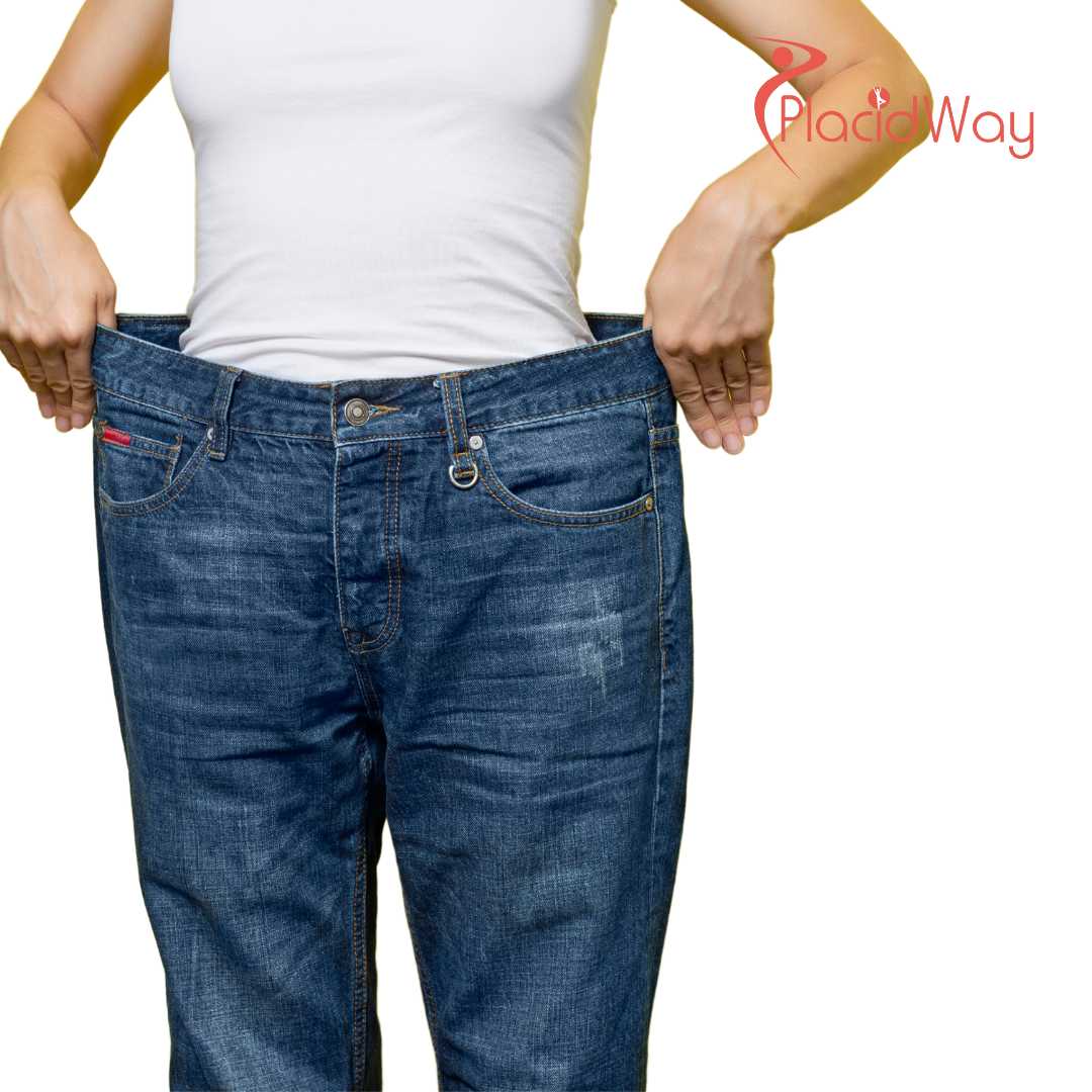 Gastric Sleeve Surgery in Turkey for Sustainable Weight Loss and Health Improvement