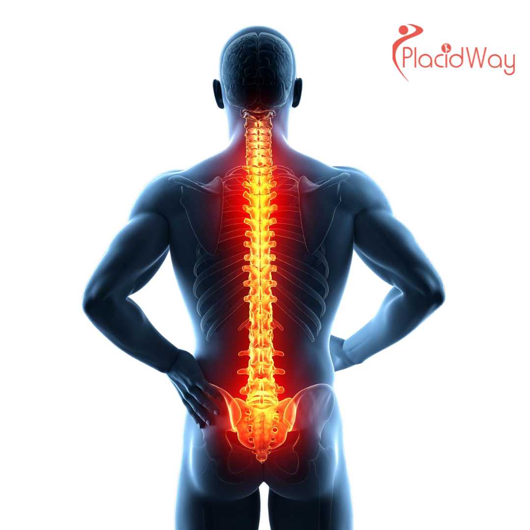 7 Top Benefits of Spine Surgery in Poland