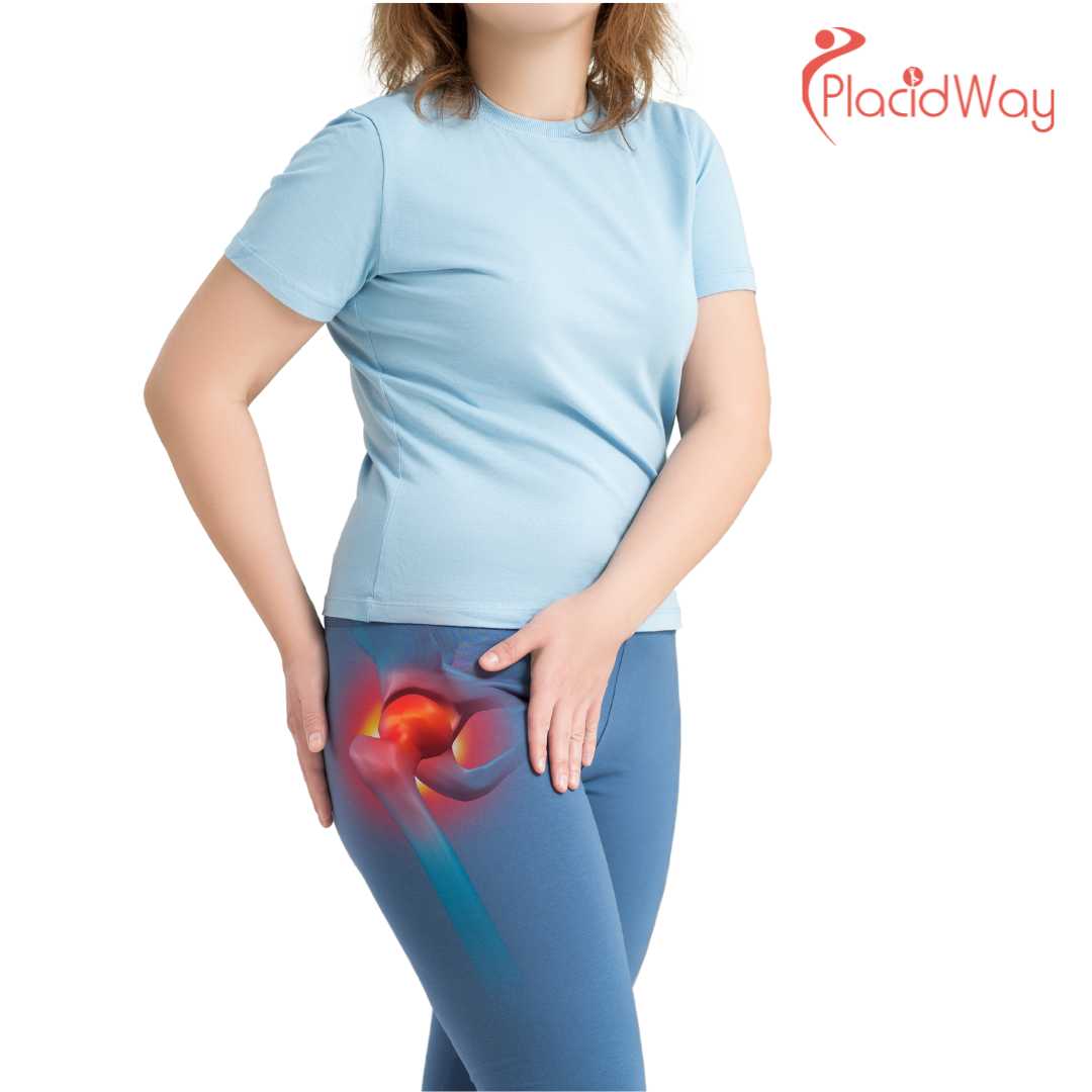 5 Benefits of Hip Replacement Surgery in Warsaw, Poland