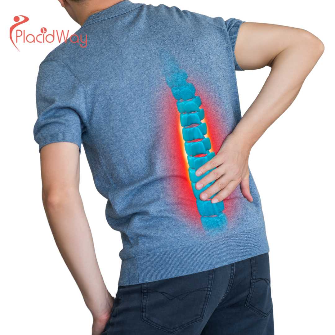 5 beneficios de la cirugía de columna y espalda en Cabo San Lucas, México