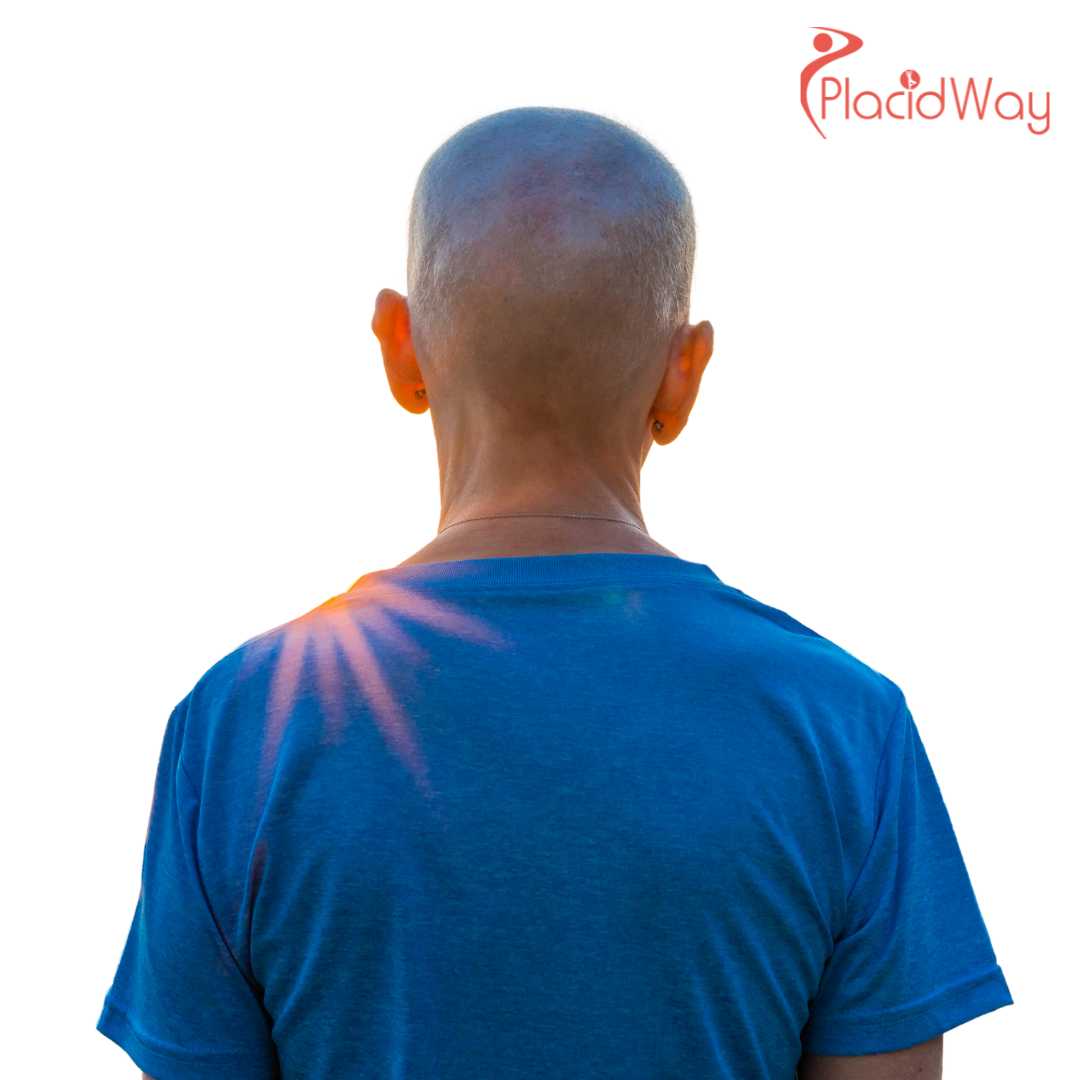Non-Surgical Alternatives for Colorectal Cancer Treatment in Tijuana
