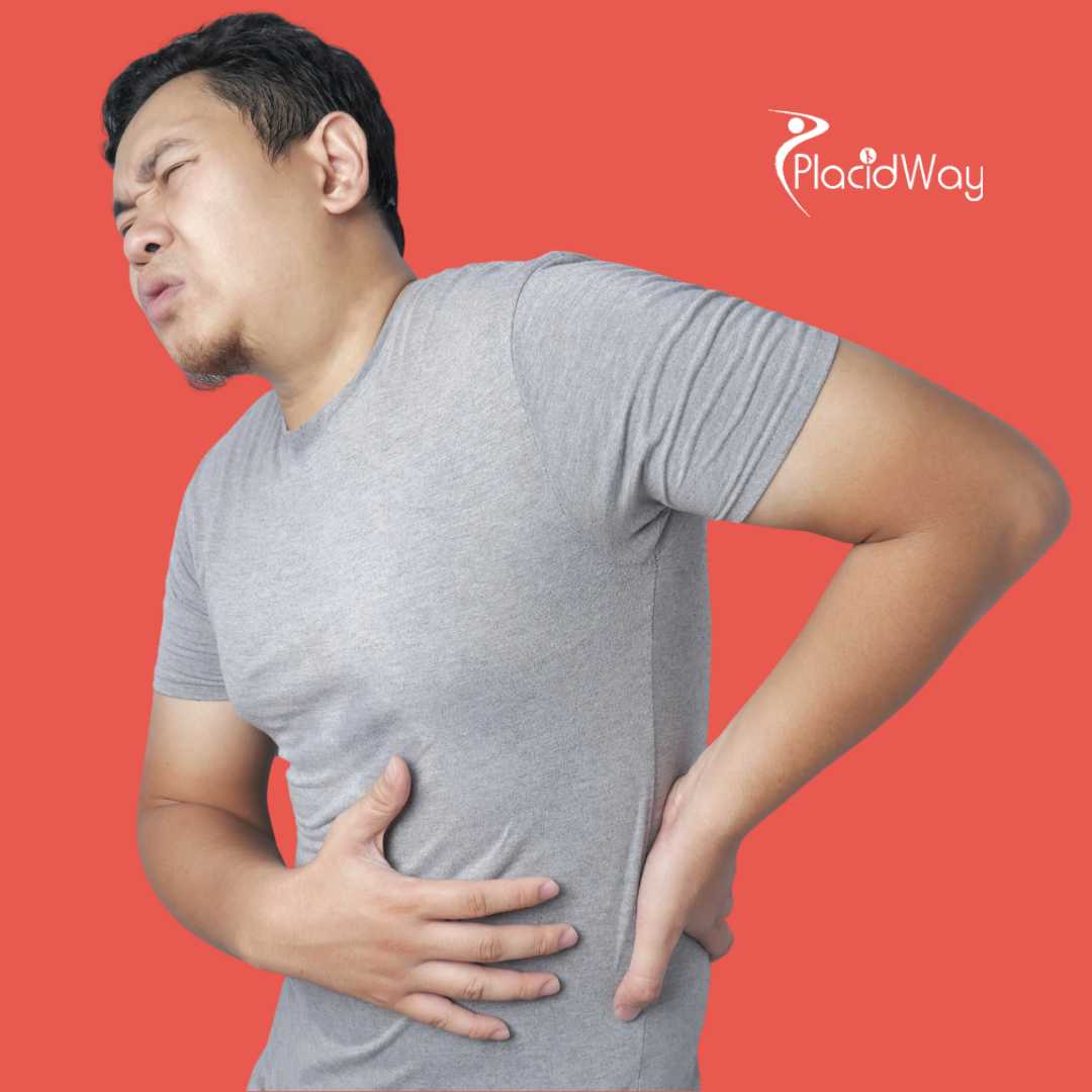 Cáncer de apéndice: explicación, tratamientos y consideraciones