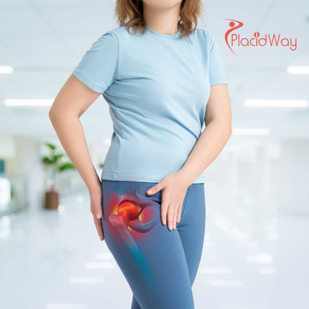 Puerto Vallarta Emerges as the Top Recovery Hub for US Seniors Seeking Luxury Hip Replacement Packages