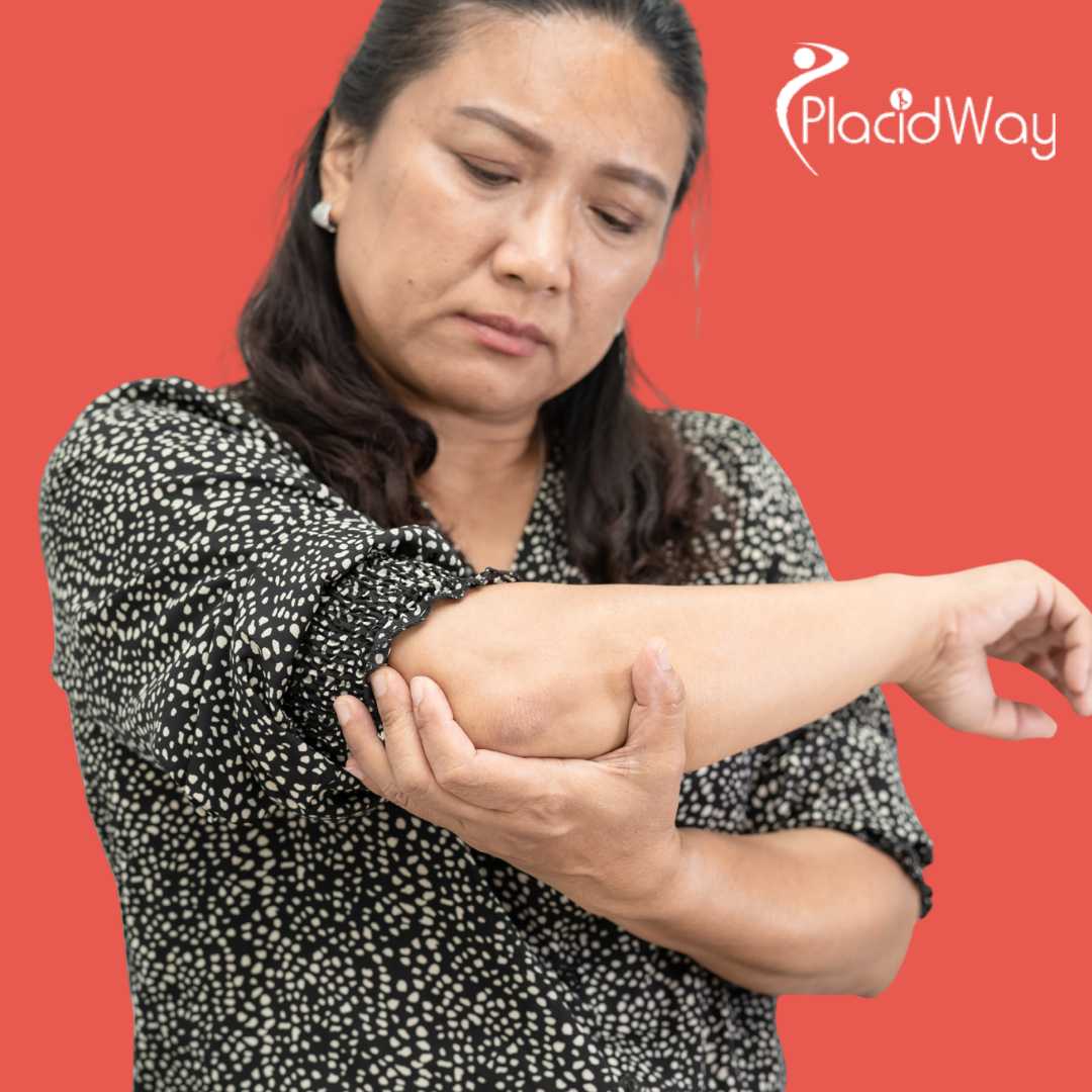 Non-Surgical Elbow Pain Relief: Singaporeans Are Flocking to Osaka for Stem Cell Therapy