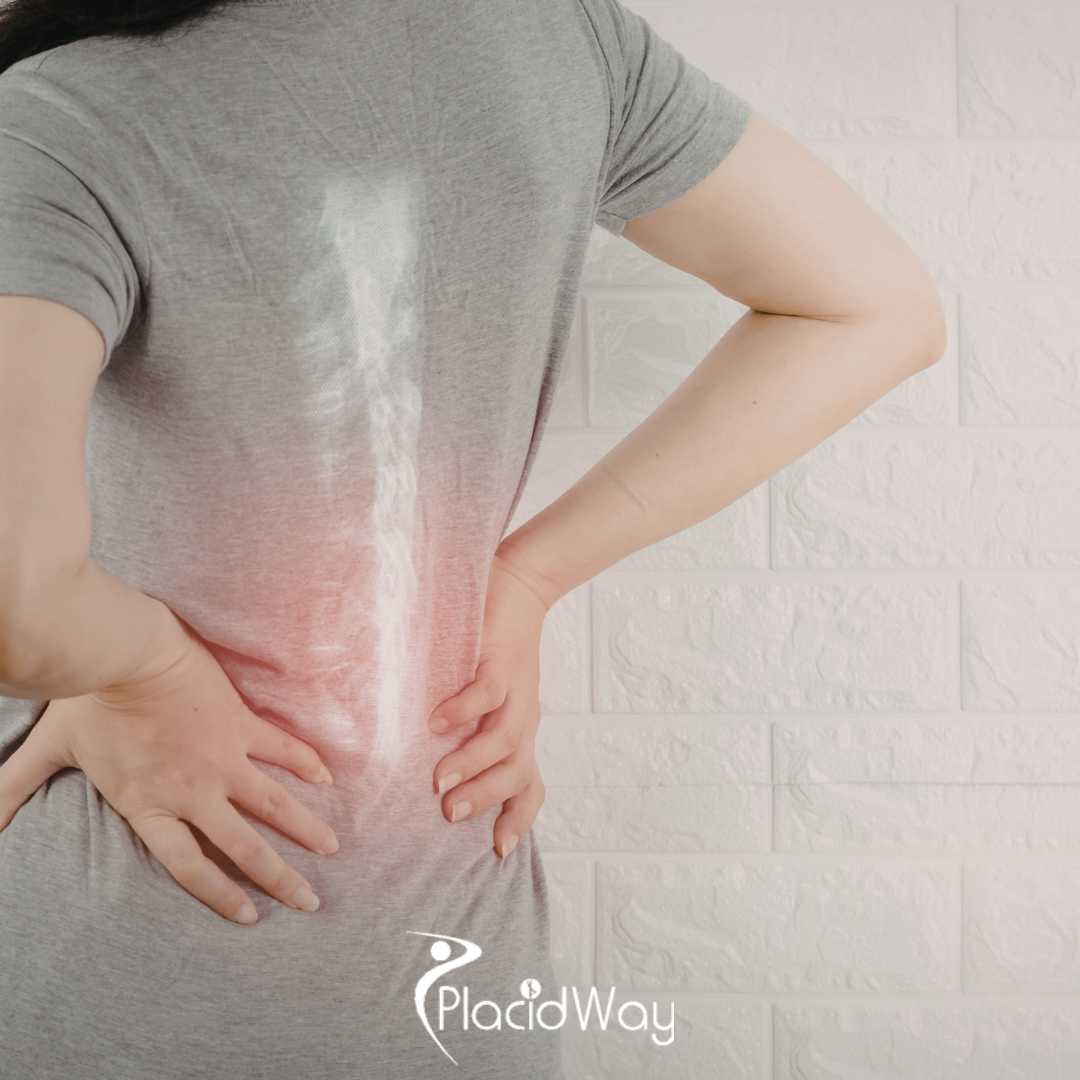 Patients Are Finding Relief from Back Spine Injuries with Stem Cells — A Non-Surgical Solution in Mexico City