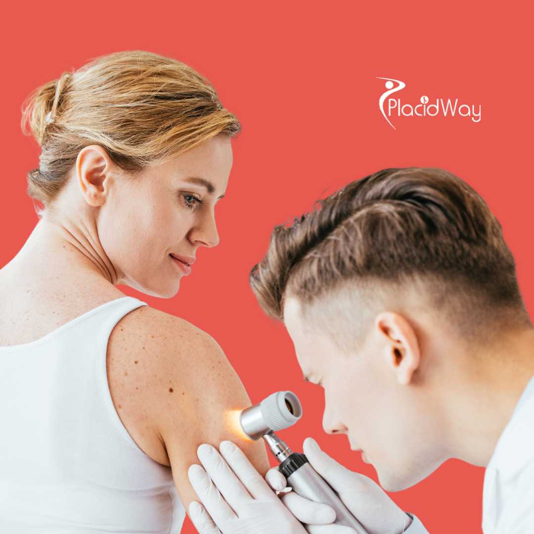 Melanoma Treatment in Tijuana, Mexico: Understanding Options After Chemotherapy Stops Working