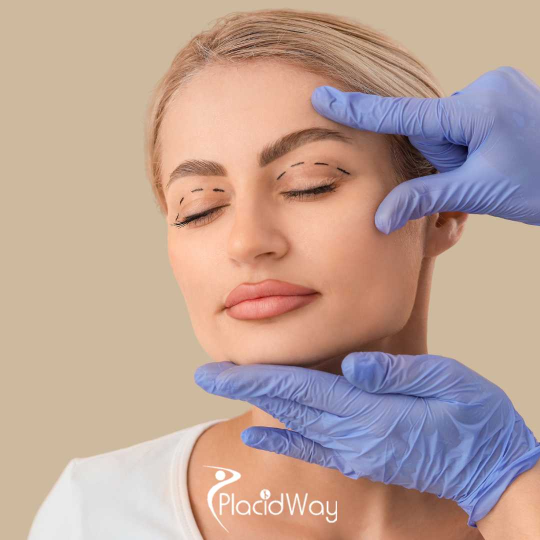 The Subtle Refresh: Why Guadalajara is the Go-To Hub for Quick-Recovery 'Fox Eye' and Eyelid Surgeries