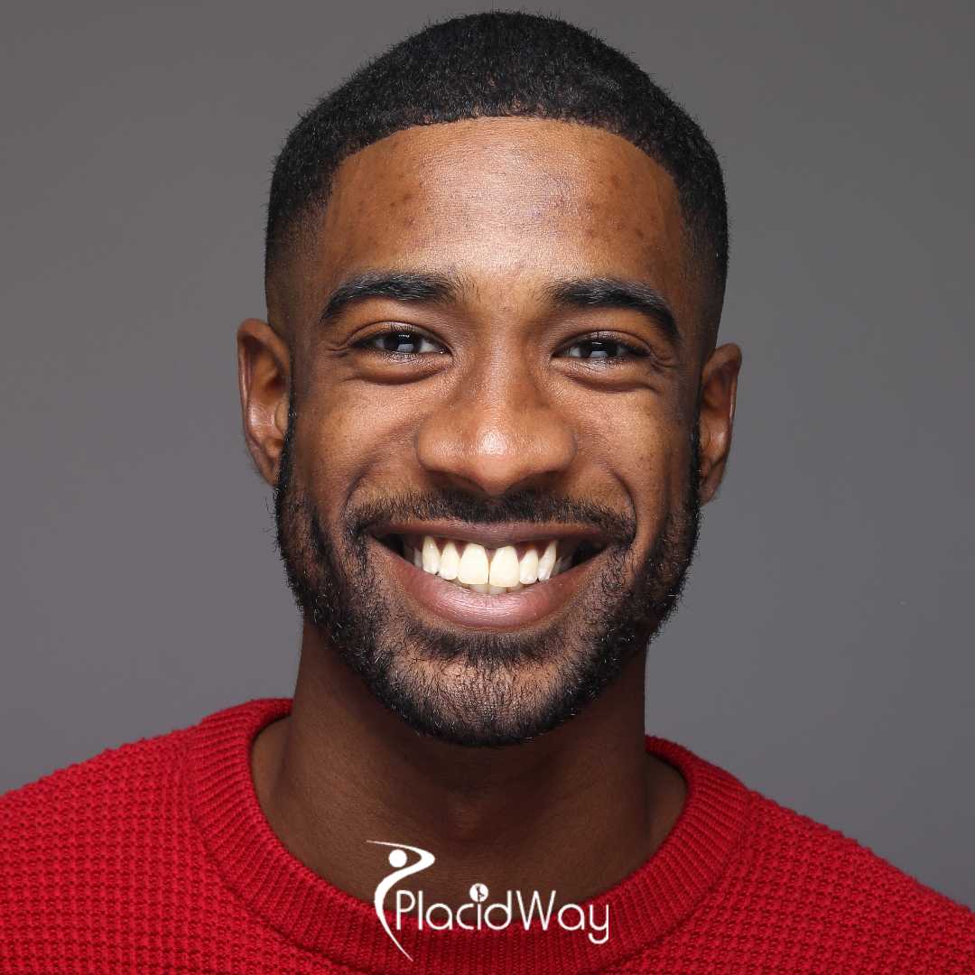 Premium Porcelain for Less: How Los Algodones is Offering World-Class Veneers at a Fraction of the Cost