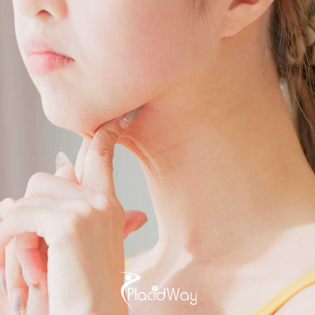 Chin Liposuction in Mexico vs USA - Finding High-Quality Care Under $3k for American Professionals