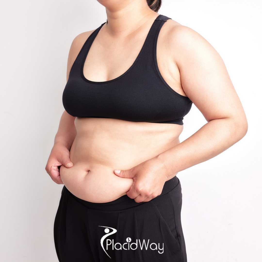 No Incisions, No Hospital Stay: The Rise of the 'Drive-In' Gastric Balloon in Piedras Negras