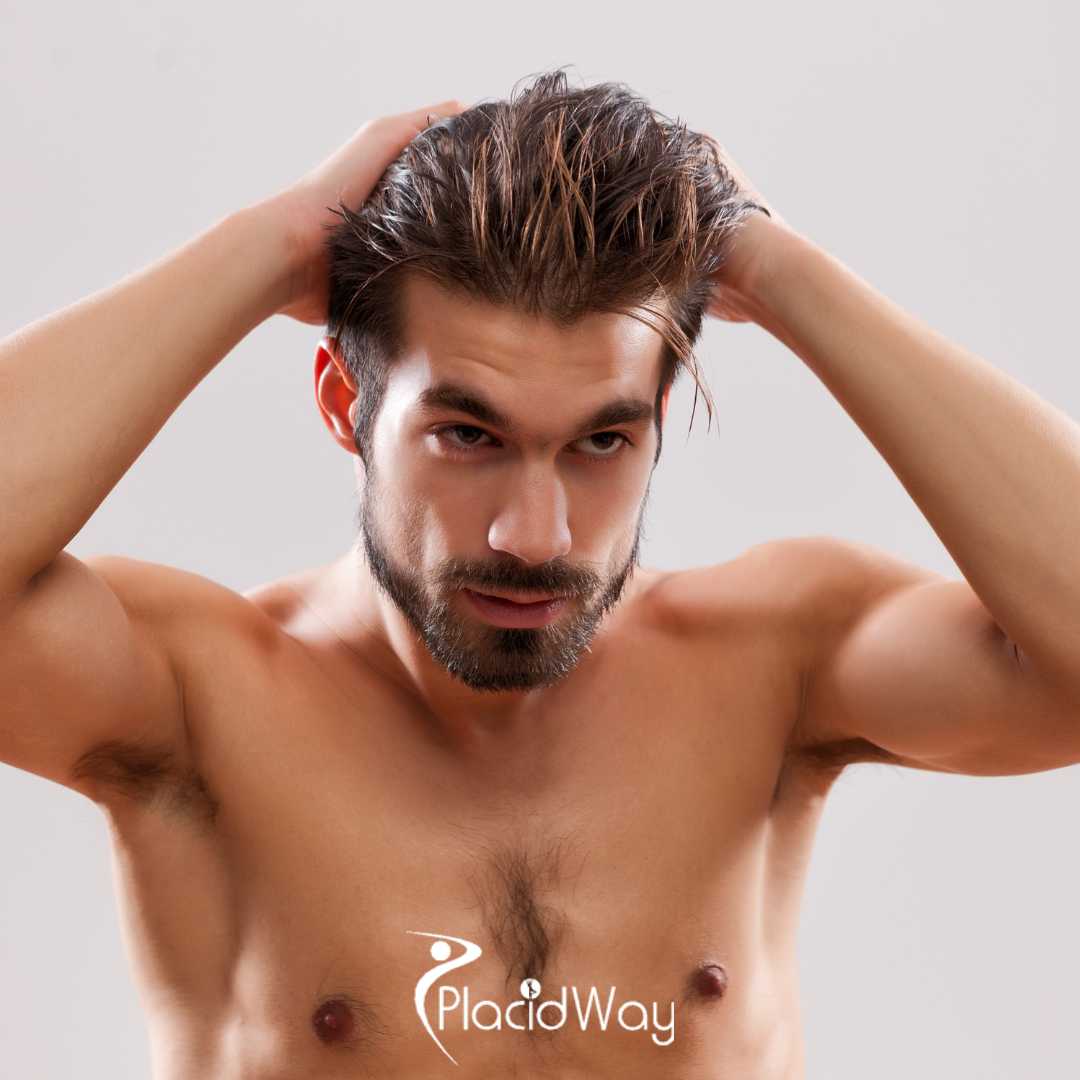 Hair Transplant in Turkey vs Ireland - Graft Prices, Hidden Fees, and Success Rates Compared for UK Men