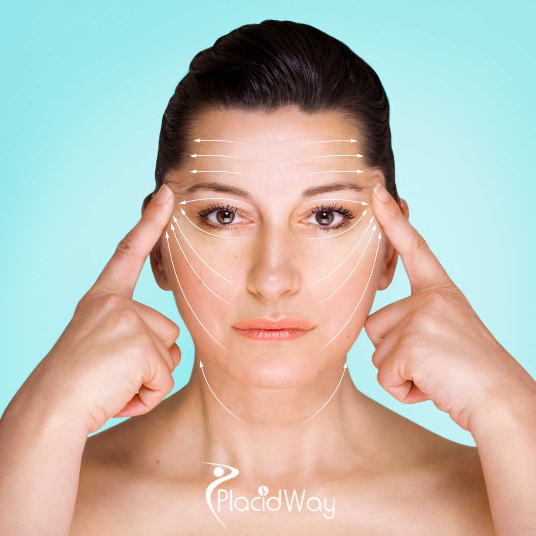 8 Secrets to Achieving a Natural Facelift (Rhytidectomy) in Mexico for US Patients Over 50