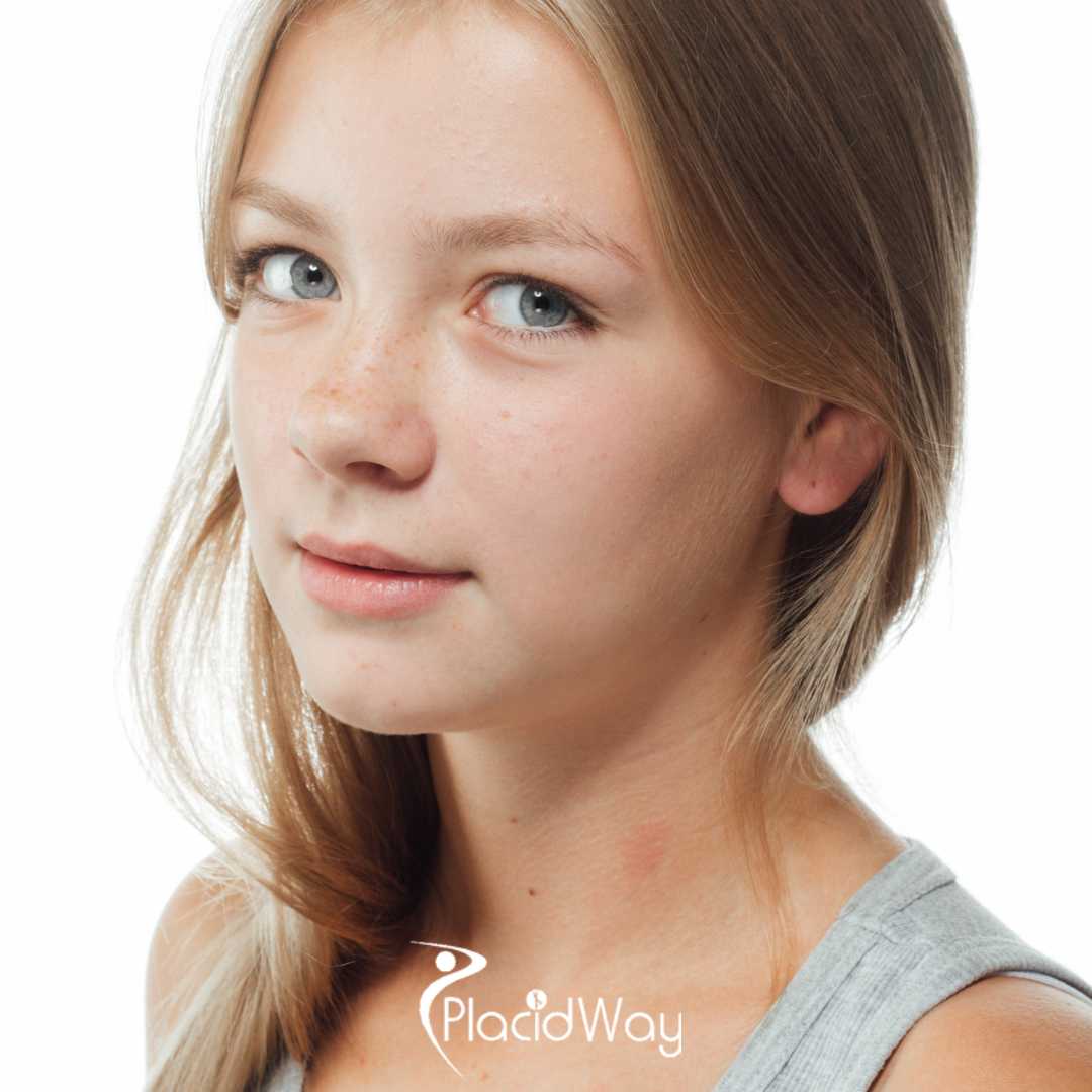 7 Things Young Adults in the US Should Ask Before Getting a Rhinoplasty in Tijuana