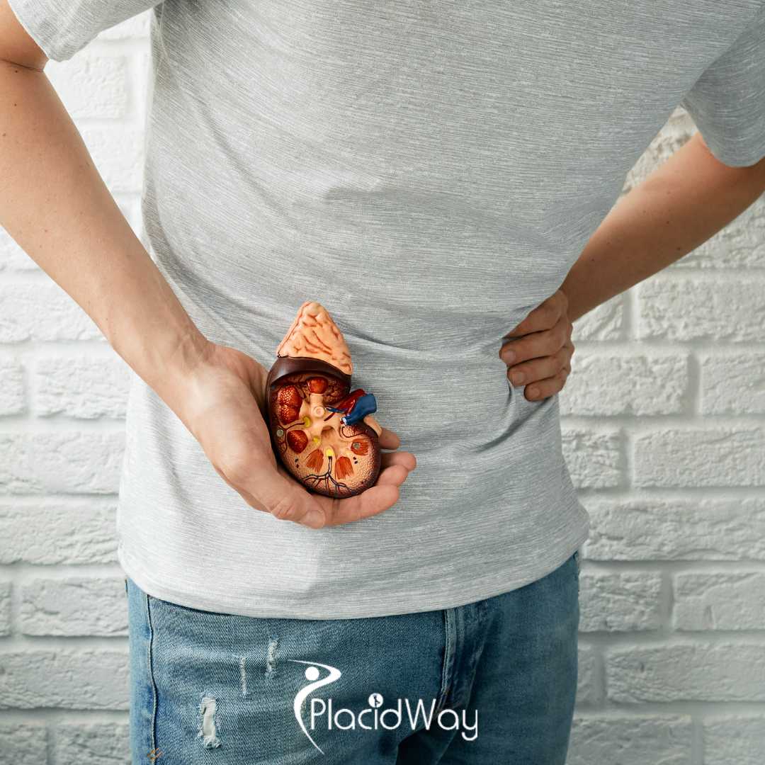 8 Things Chronic Kidney Disease Patients From Singapore Must Know Before Starting Stem Cell Therapy in Malaysia