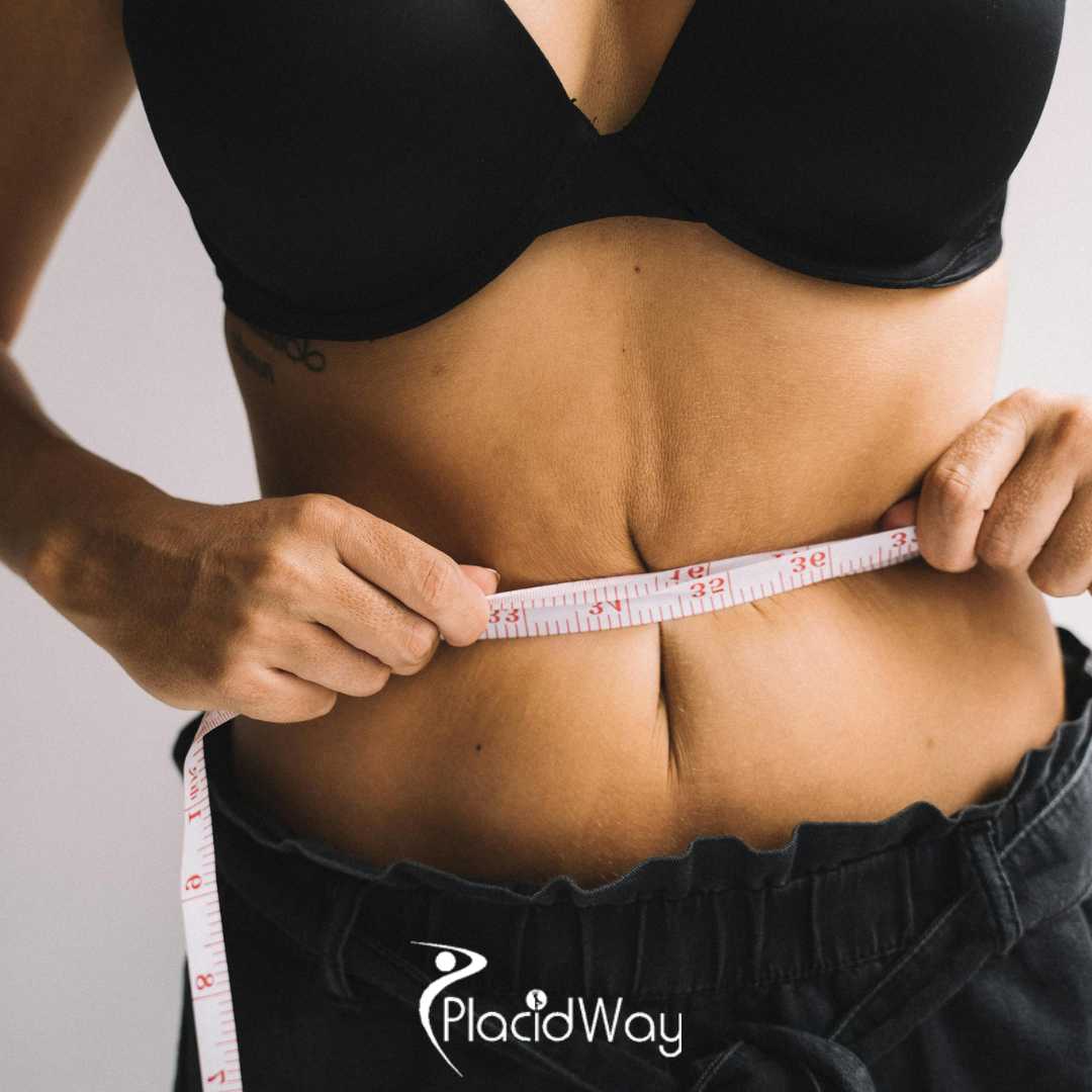 7 Reasons UK Patients Are Switching from Sleeve to Roux-en-Y Gastric Bypass in Istanbul