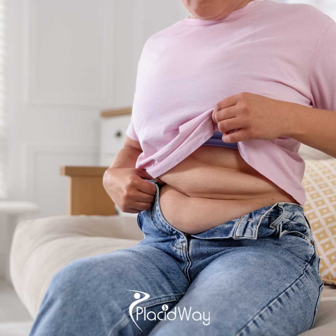 Benefits of Metabolic Gastric Bypass Surgery in Turkey for Patients with Type 2 Diabetes