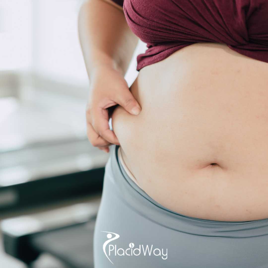 Tummy Tuck Gangnam Korea: Secret to Flawless Abdominal Contouring