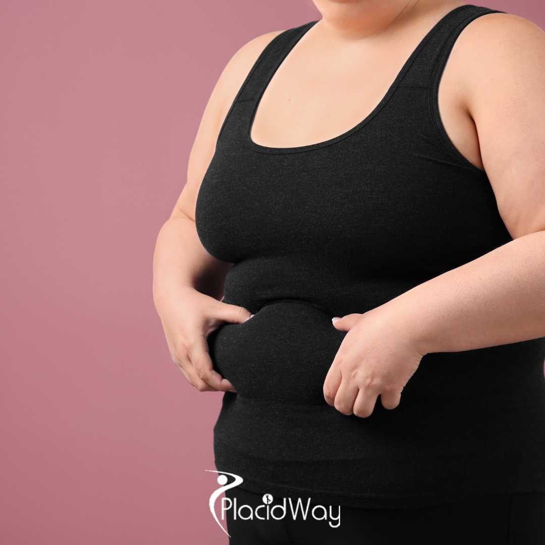 The 'Internal Corset' Trend: Why 2026 Seoul Tummy Tucks Prioritize Diastasis Repair for Global Travelers