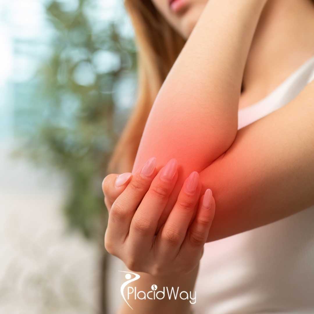 Why are Patients Turning to Ankara for High-Concentrate Stem Cell Joint Repair?