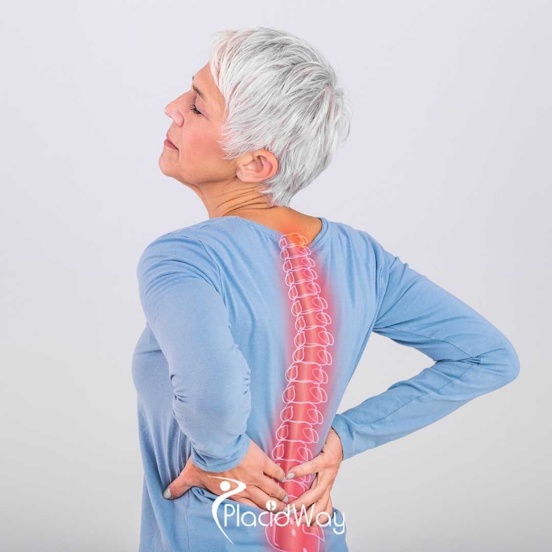 Affordable Spine Surgery in Turkey for Romanian Patients: Costs, Recovery, and Clinic Guide