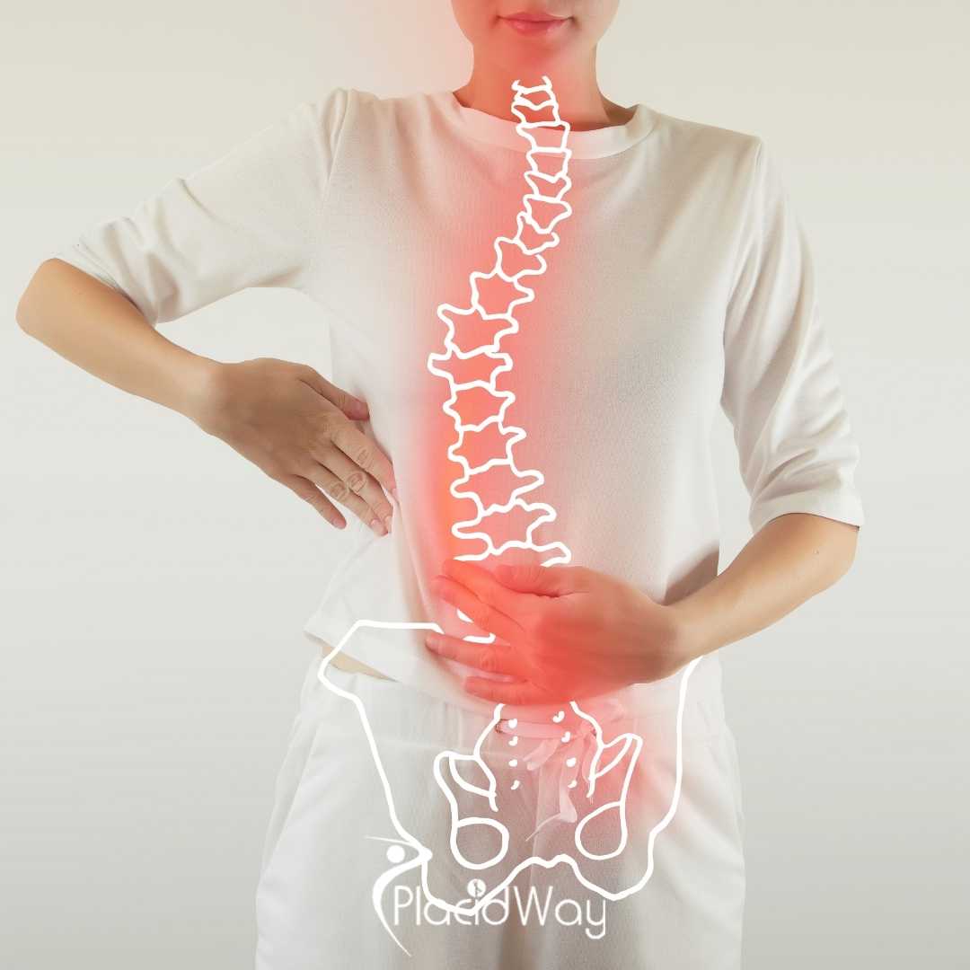 Stem Cell Treatment for Spinal Cord Injuries in Colombia: Protocols & Recovery