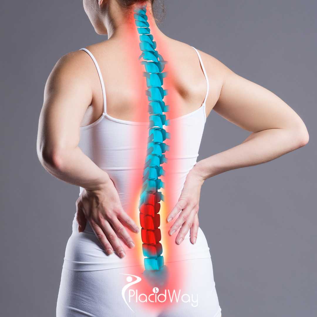A Guide to Germany Spine Surgery for CIS Patients: Visa, Clinics and Travel Cost