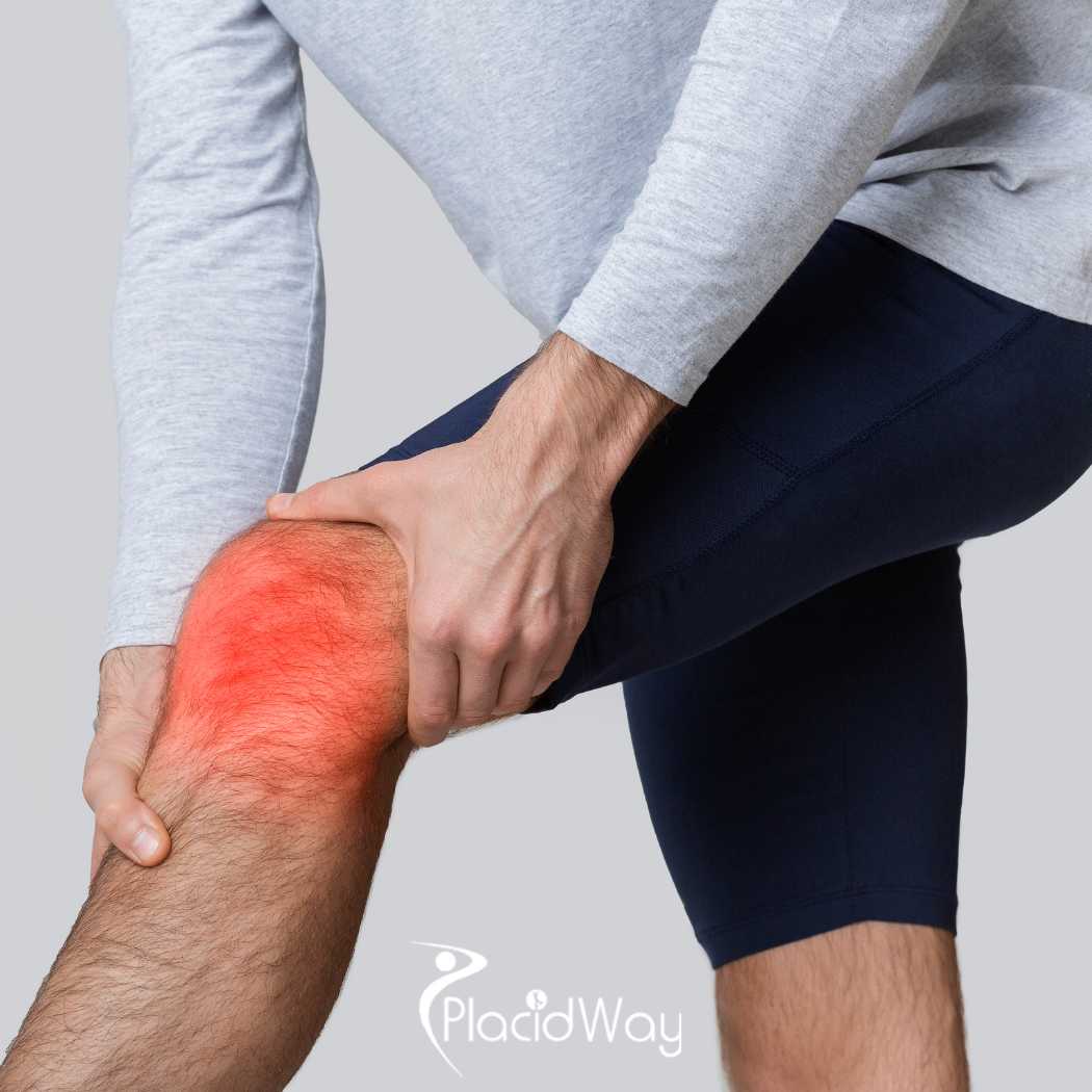 A Guide to Knee Replacement Surgery in Turkey