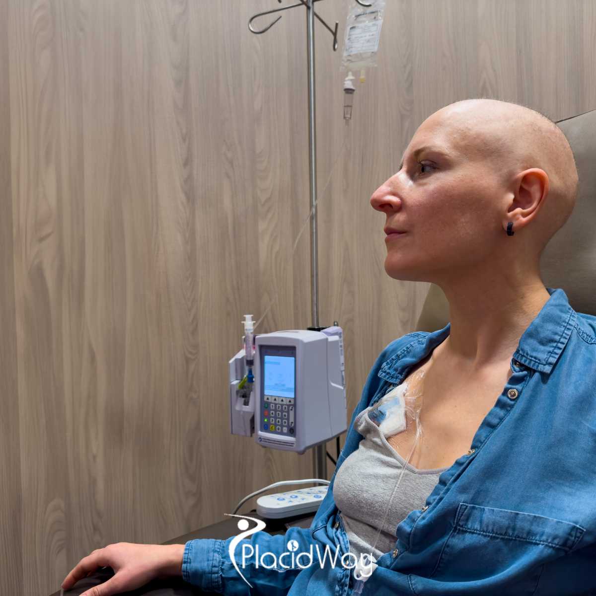 Immunity Therapy Center in Mexico: A Guide to Alternative Breast Cancer Treatment