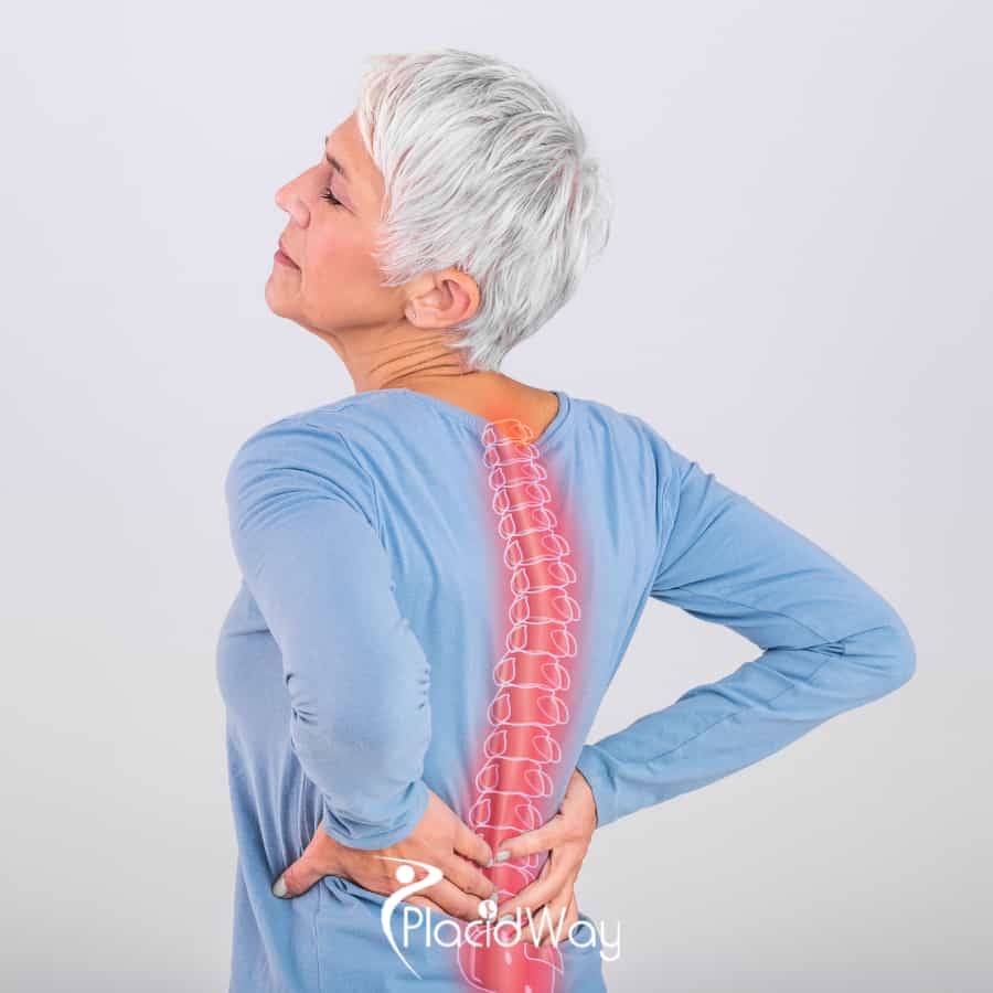 Back Surgery in Mexico - Spine Treatment Cost & Clinics