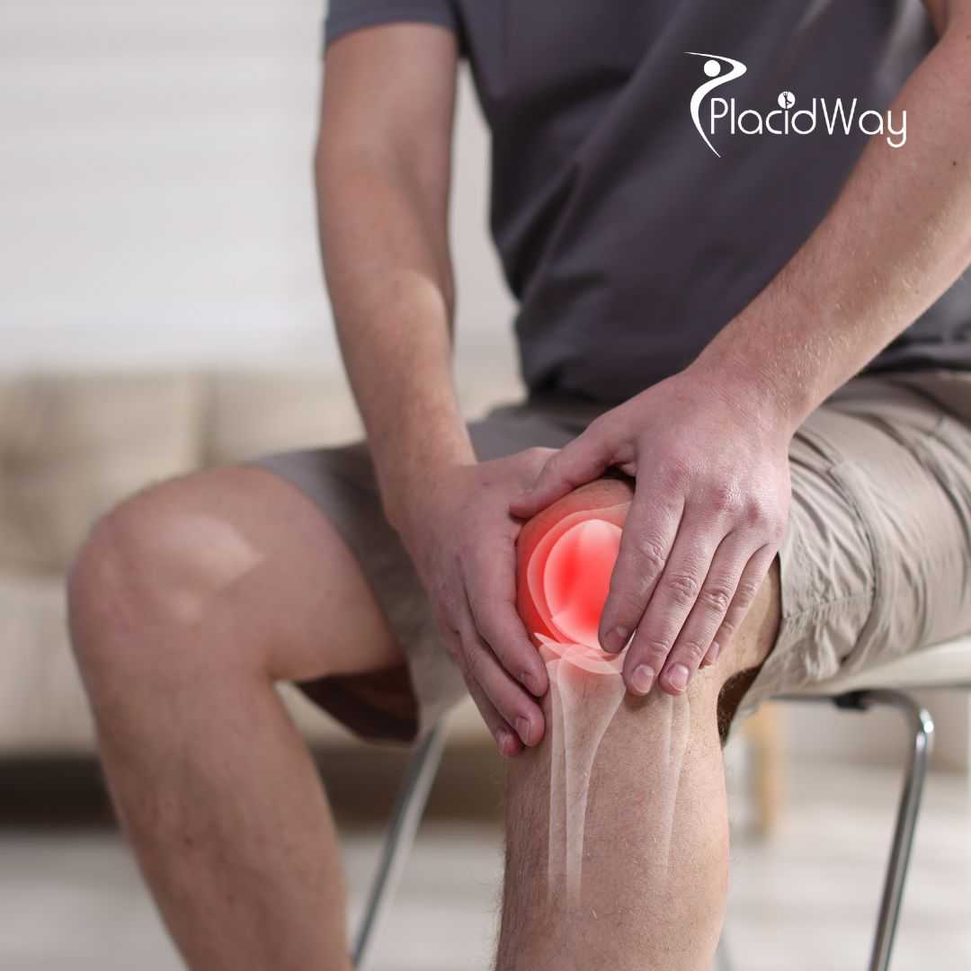 One-Year Clinical Evidence: Stem Cell Therapy for Knee Osteoarthritis in Osaka, Japan by Cell Grand Clinic