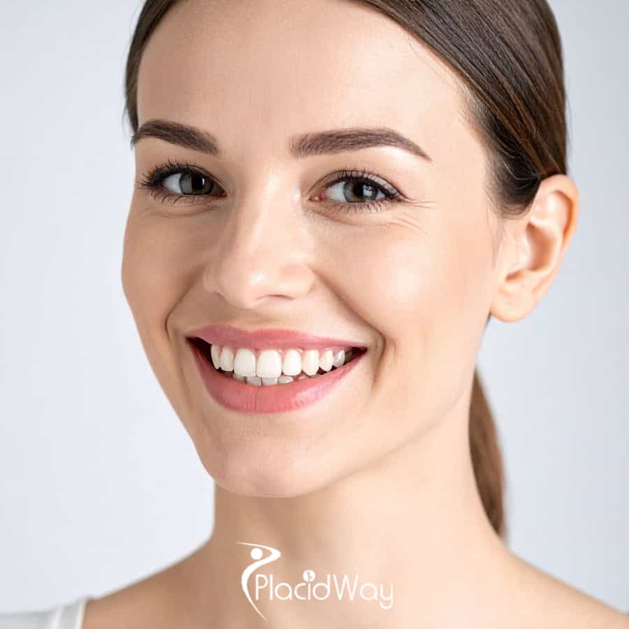 Dental Veneers in Albania for French Patients: Costs, Treatment Time & Travel Planning