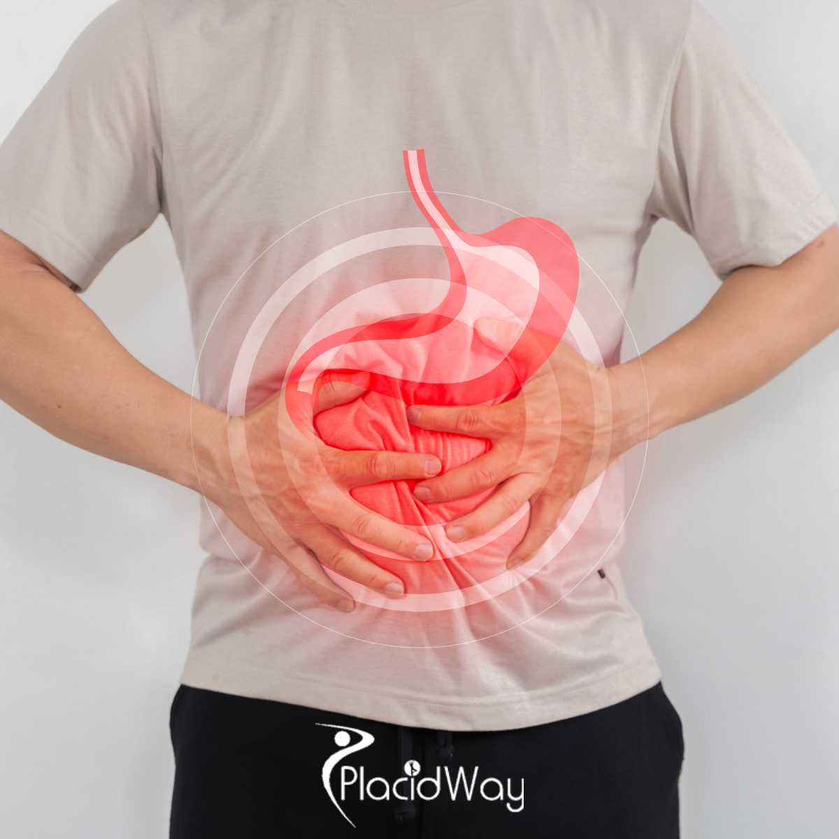 I Was Diagnosed With a Gastrointestinal Stromal Tumor (GIST)—What Treatment Options Should I Consider in Mexico?