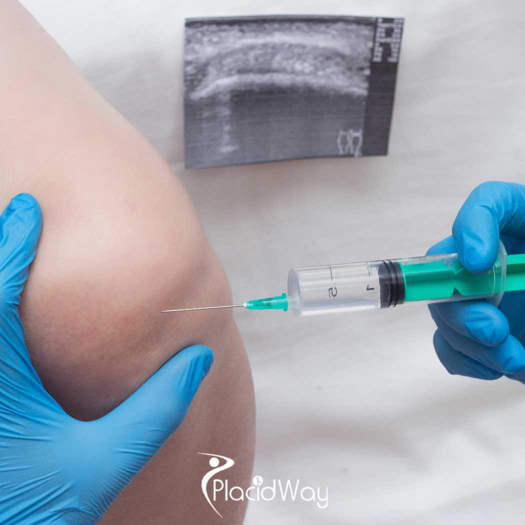 Affordable Stem Cell Cartilage Therapy in Mexico for Canadians