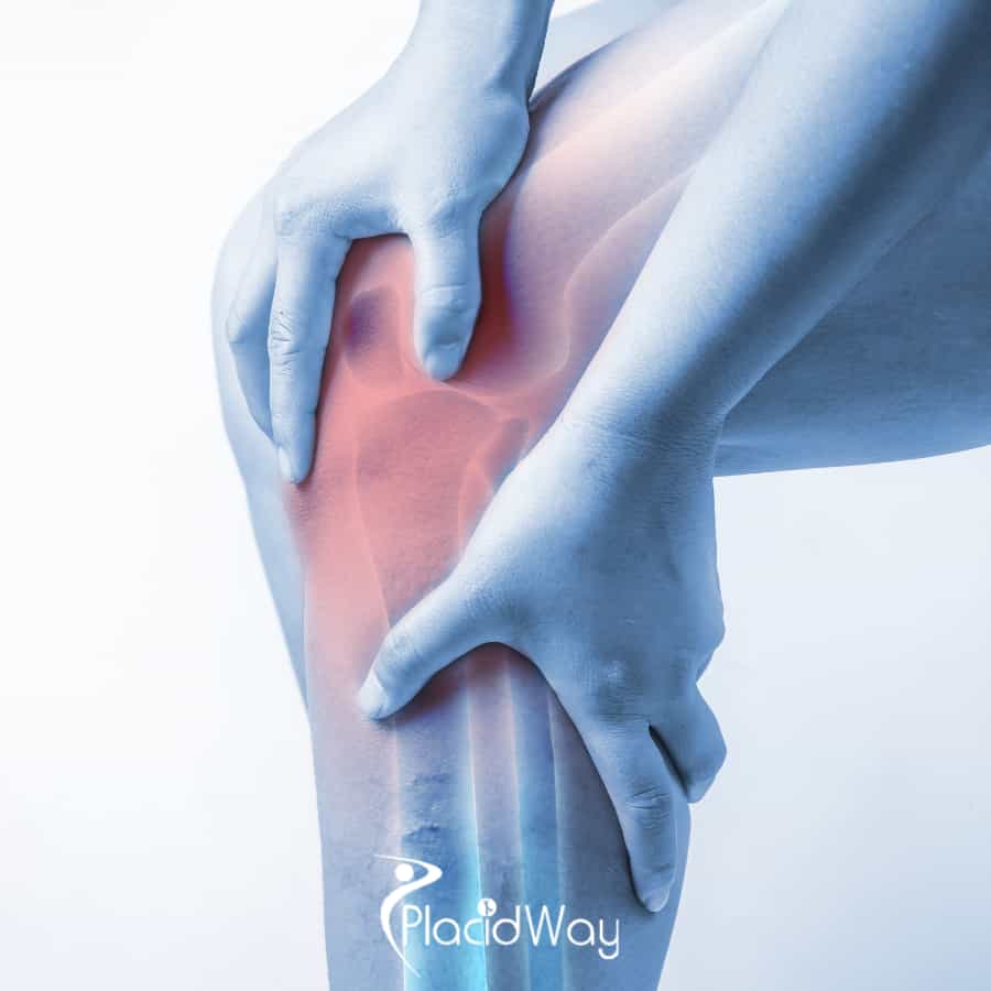 Knee Replacement Surgery: Mexico vs USA - Cost, Quality & Recovery