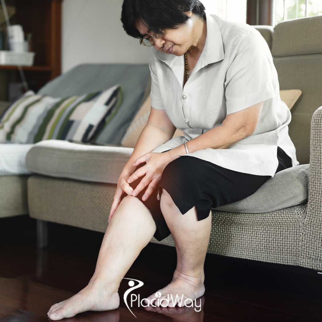 Stem Cell Therapy for Osteoarthritis in Malaysia for Joint Health and Pain Management 