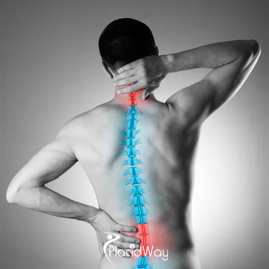 Spine Surgery in Tijuana, Mexico: Cost Savings and Top Clinics for Californians