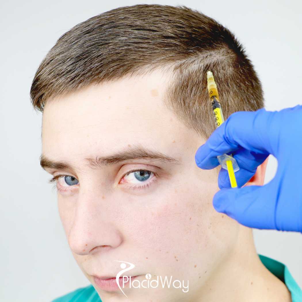 Stem Cell Therapy for Hair Regrowth in Japan: A Guide to Regenerative Restoration