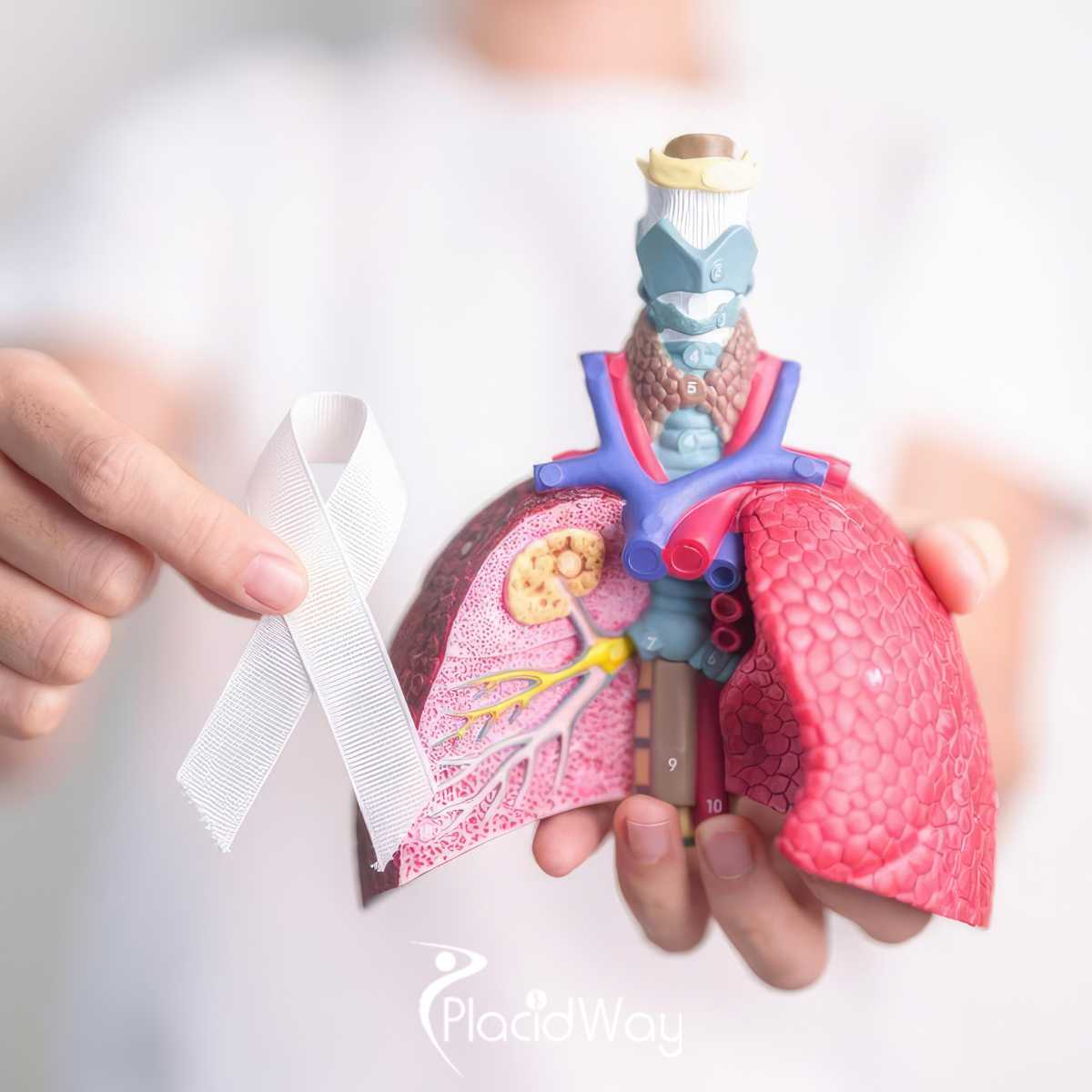 Innovative Immunotherapy Approaches for Lung Cancer: Trends from Mexican Cancer Centers