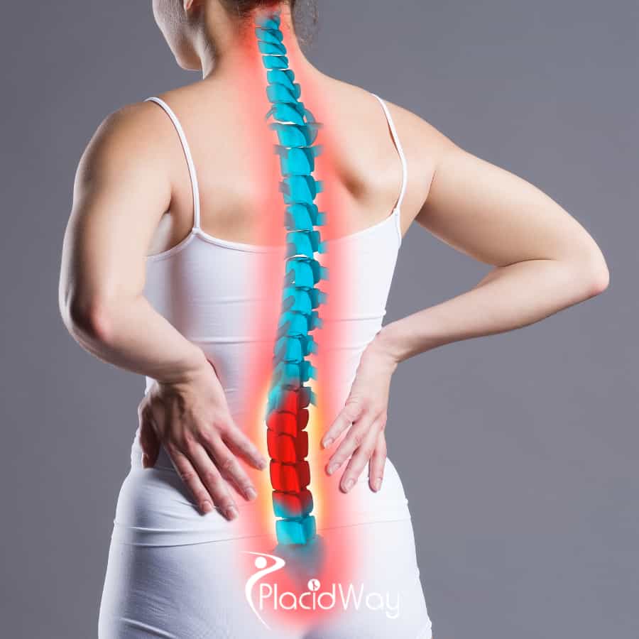 Laminectomy for Spinal Stenosis in Turkey: A Guide for UK Medical Travellers