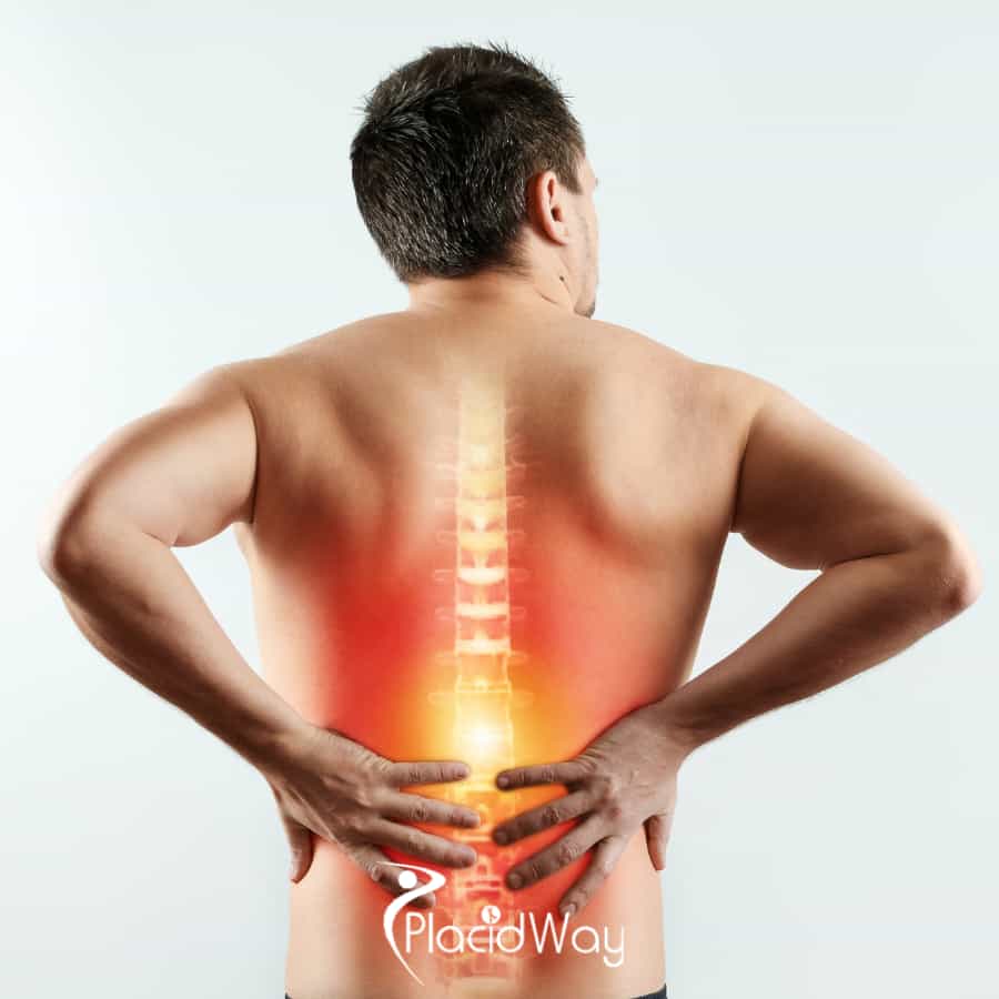 5 Best Spine Surgeons in Turkey