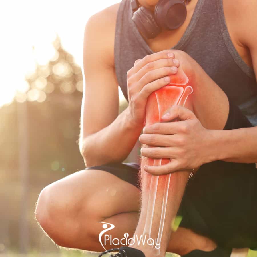 6 Things to Know About ACL, Meniscus & Sports Surgery in Tijuana