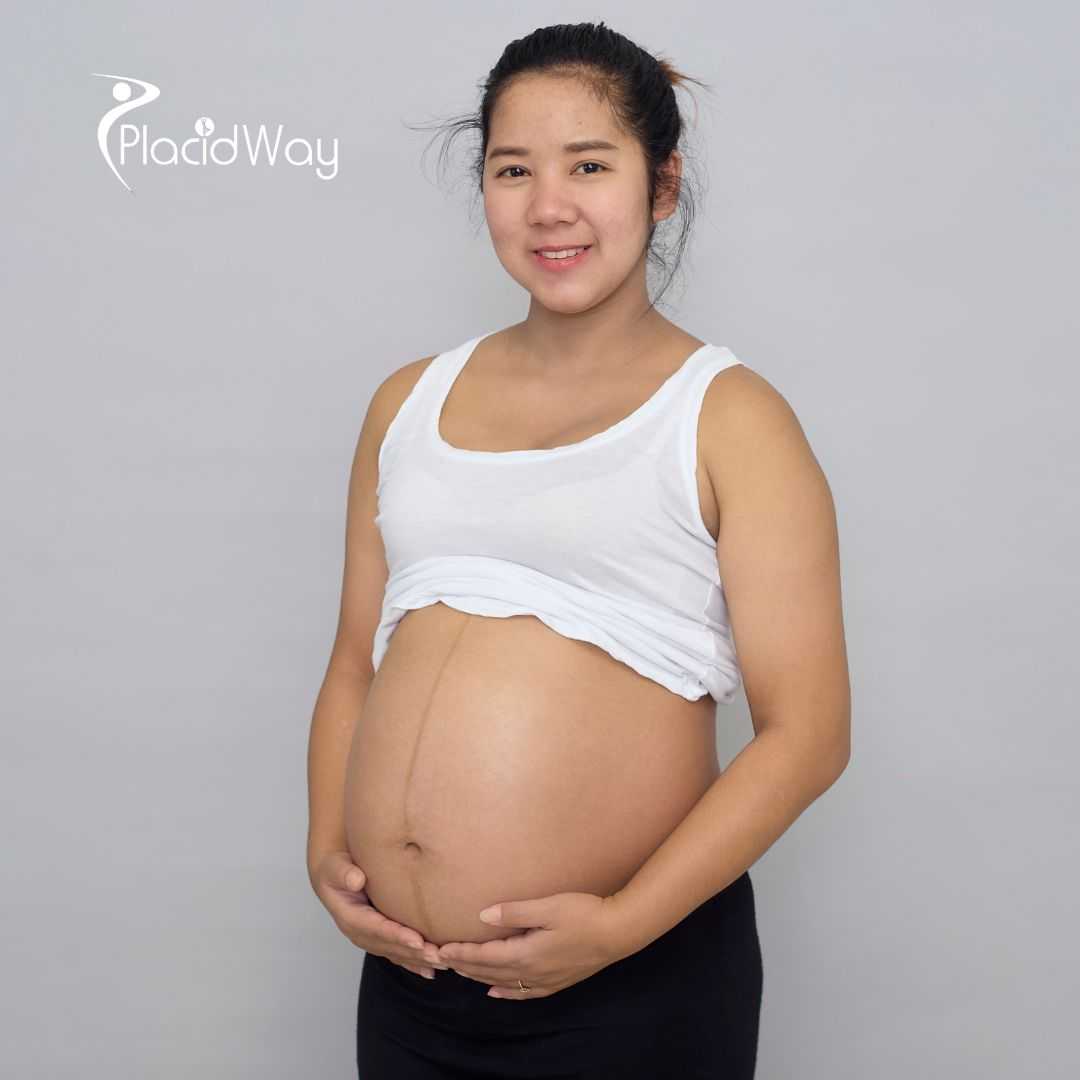 Best IVF Clinics in Bangkok Thailand: Expert Care for Your Fertility Journey