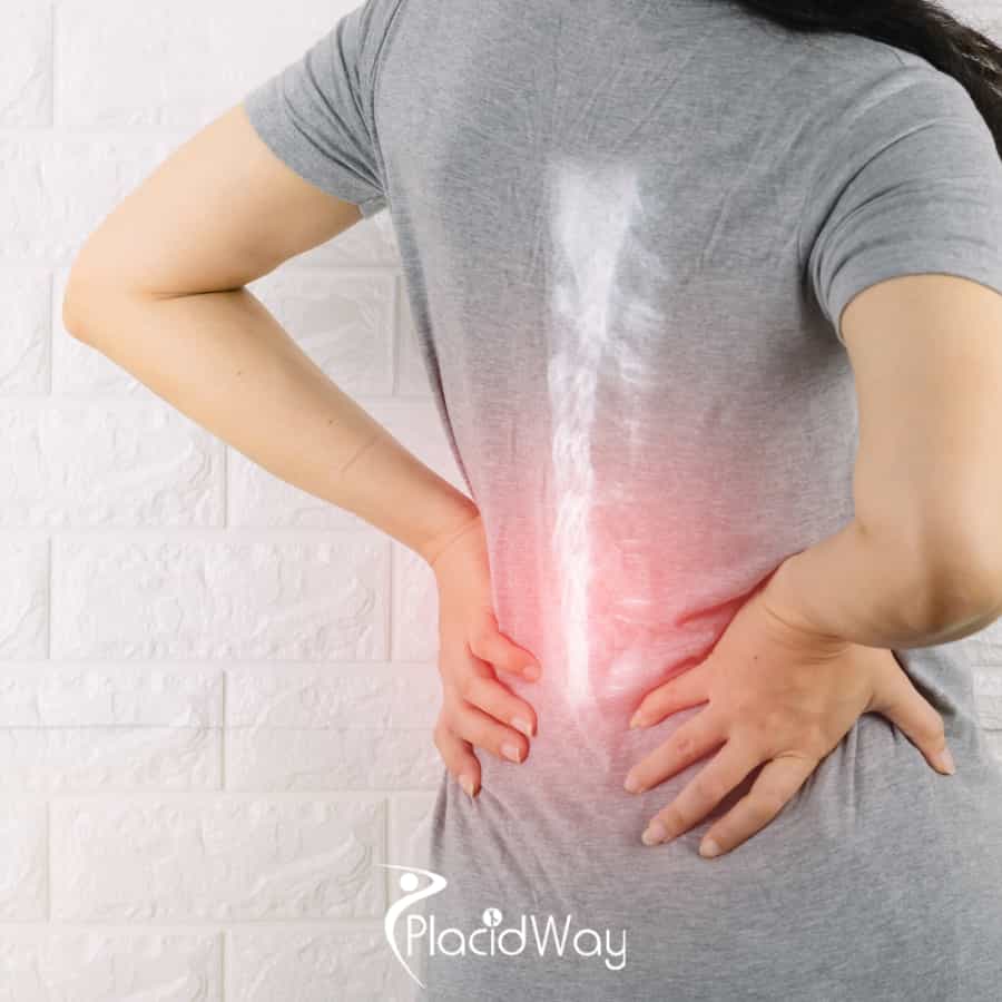 Spine Surgery in Turkey vs UK: Your Ultimate Comparison Guide