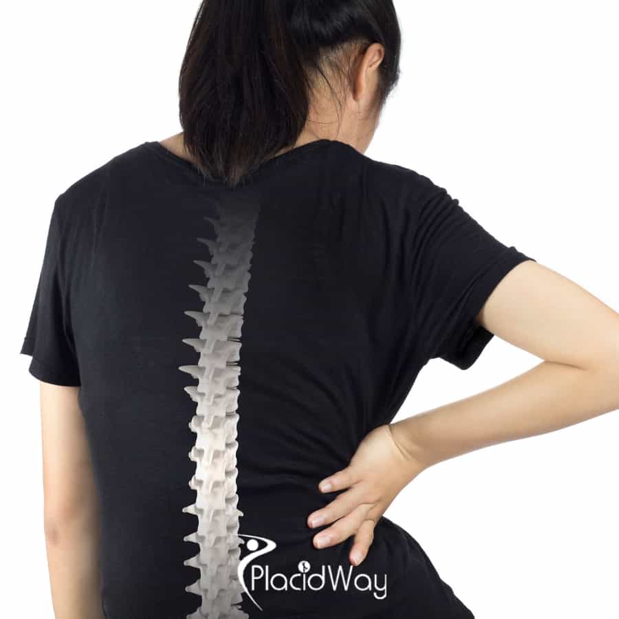 Artificial Disc Replacement in Turkey: A Revolutionary Option for German Patients with Degenerative Disc Disease