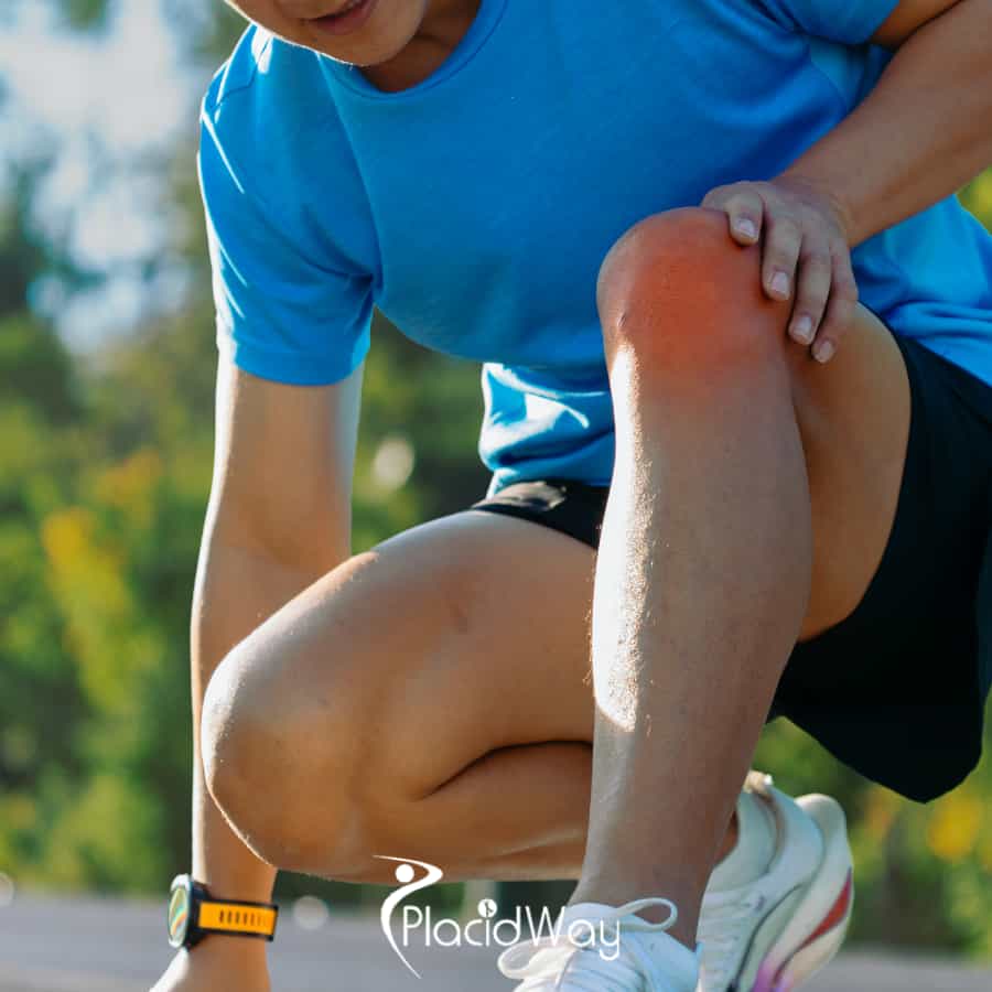 Knee Replacement Surgery in Turkey: Restore Mobility with High-Quality Treatment for Australian Tourists