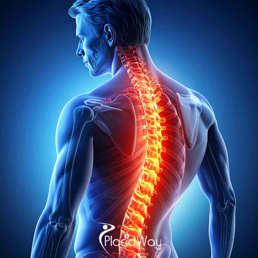 How Minimally Invasive Orthopedic Surgeries in Mexico are Redefining Recovery